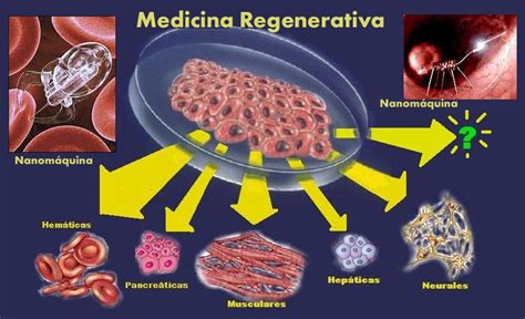 Representación esquemática del uso de tejido porcino en la medicina regenerativa