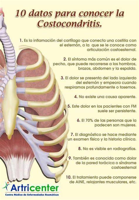 Síntomas comunes de la costocondritis