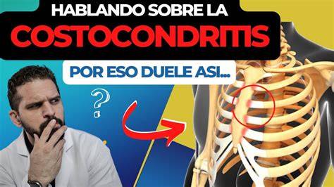 Opciones de tratamiento para la costocondritis