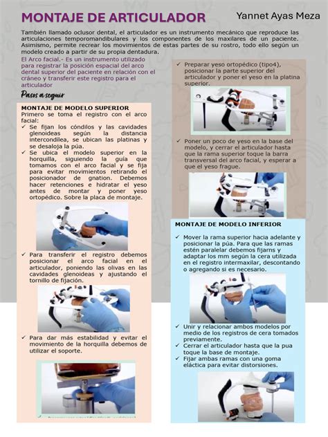 esquema de montaje del volován paso a paso