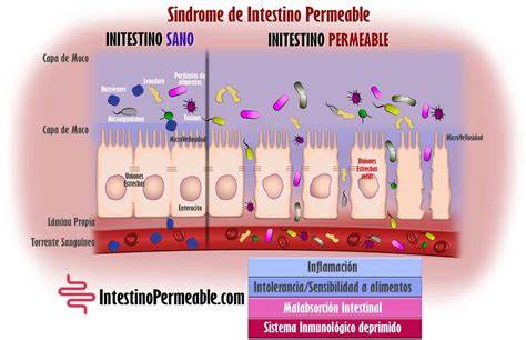 Esquema del intestino permeable