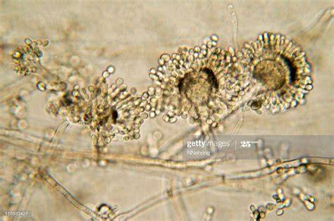 Imagen de una muestra de moho del pan teñida con azul de metileno bajo el microscopio