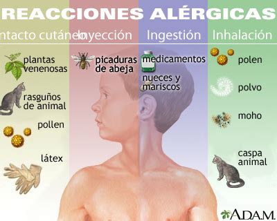 Síntomas comunes de las alergias