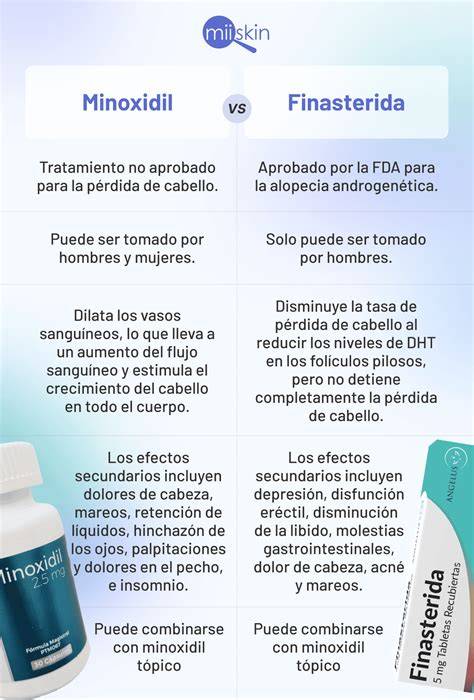 Tabla comparativa entre Finasterida y Minoxidil para el tratamiento de la alopecia