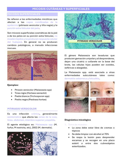 Esquema de las micosis cutáneas más comunes