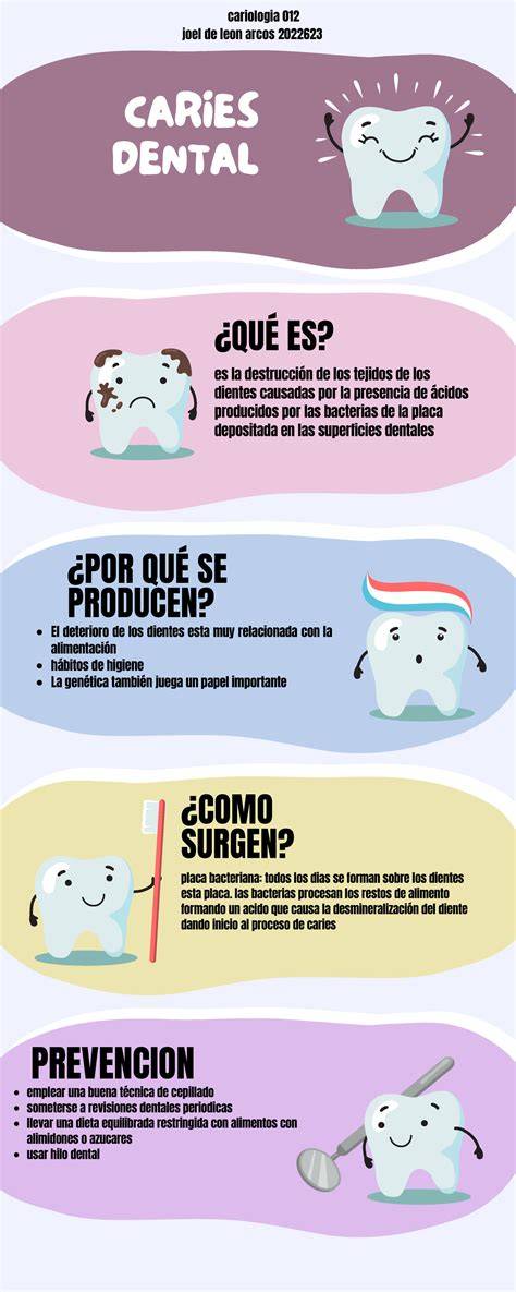 Infografía sobre cómo se forma la caries dental