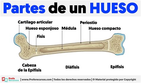 Representación de un hueso con erosión