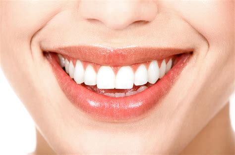 Esquema visual de una sonrisa saludable y blanca