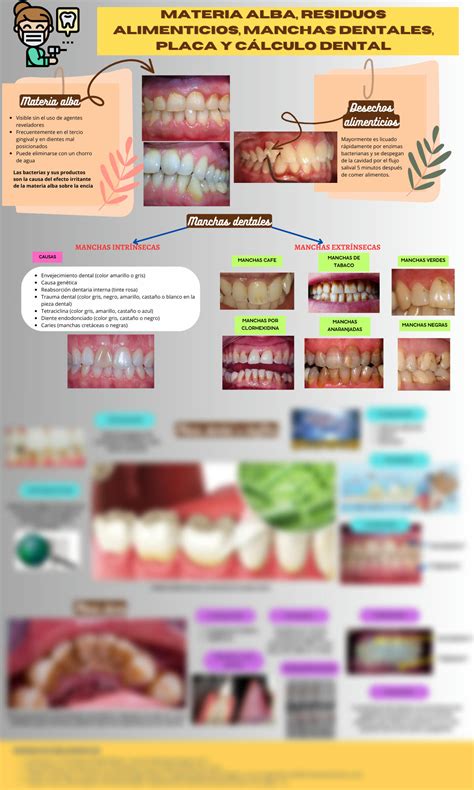Infografía sobre la eliminación de manchas dentales