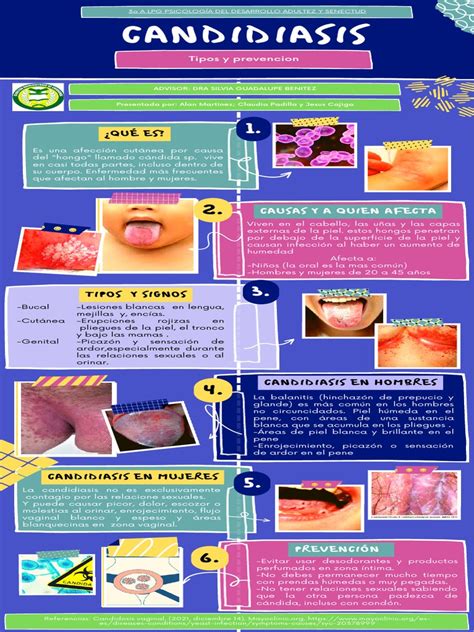 Infografía sobre las causas y factores de riesgo de la candidiasis oral