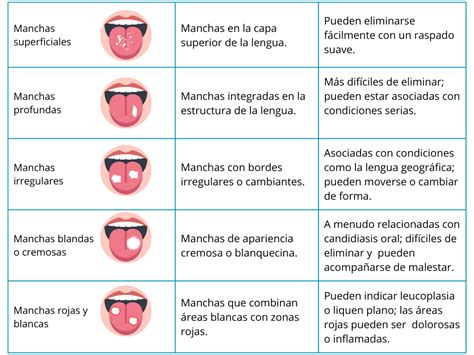 Manchas blancas de candidiasis oral en la lengua
