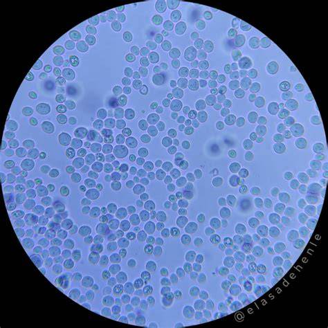 Ilustración de levadura bajo el microscopio