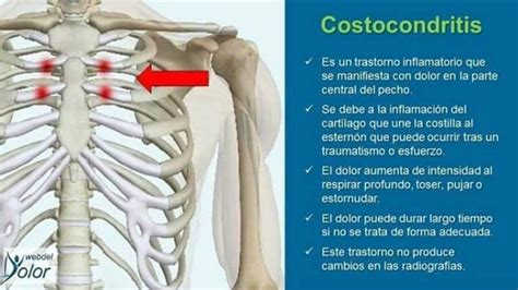 Esquema de las causas de condritis y pericondritis