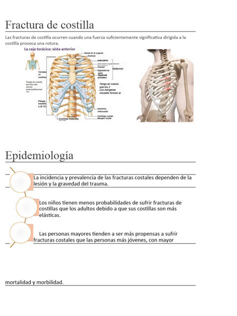 Tabla comparativa: Contusión vs. Fractura de Costilla