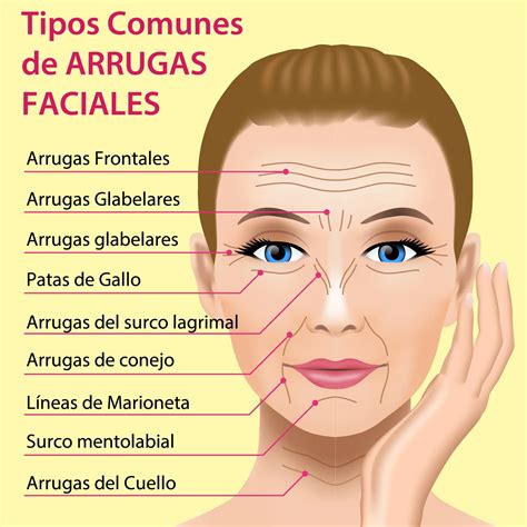 Tipos de arrugas faciales