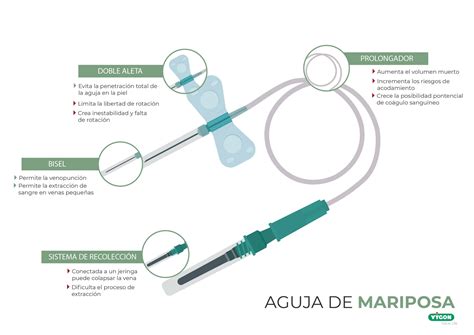 Infografía detallando los componentes de una aguja mariposa