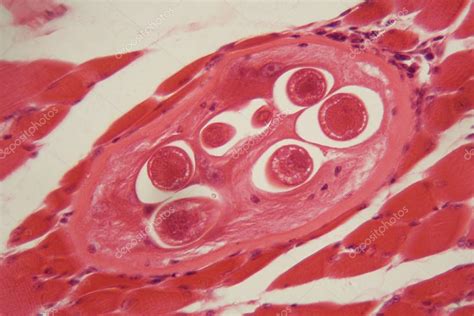 Microscopía de larvas de Trichinella en tejido muscular