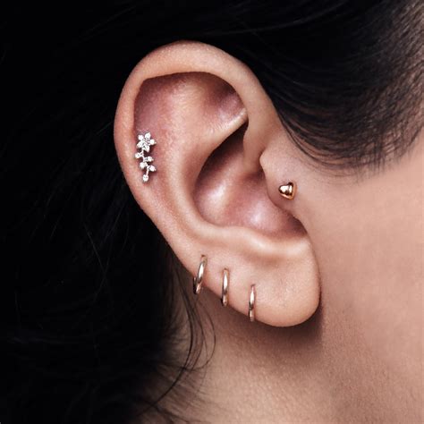 Piercing en el cartílago de la oreja con signos de infección