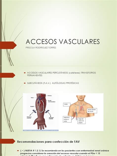 Clasificación de Dispositivos de Acceso Vascular Periférico