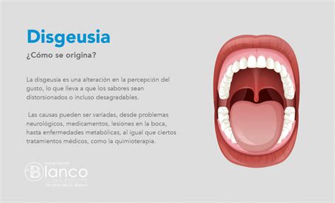 Espectro de sabores en la disgeusia