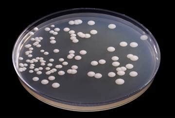 Placa de Petri con agar YGC mostrando crecimiento de levaduras y mohos