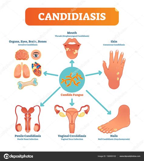 Microorganismos de Candida en el cuerpo humano
