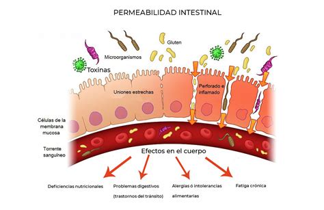 Esquema de la permeabilidad intestinal y el impacto de la candidiasis