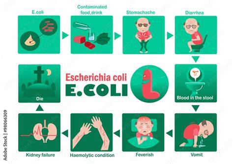 Gráfico de los síntomas de la infección por E. coli