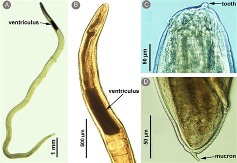 Larva de Anisakis