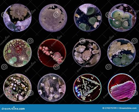 Cultivos de bacterias y hongos en placas de Petri