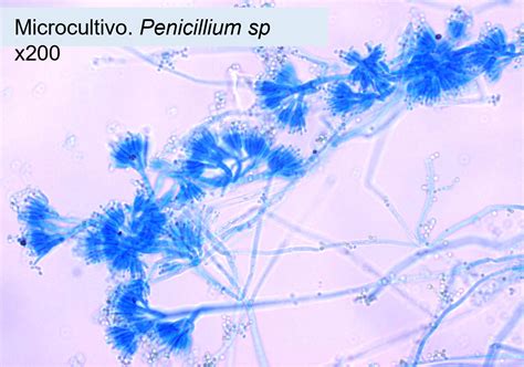 Captura al microscopio óptico de un fragmento de moho teñido con azul de metileno