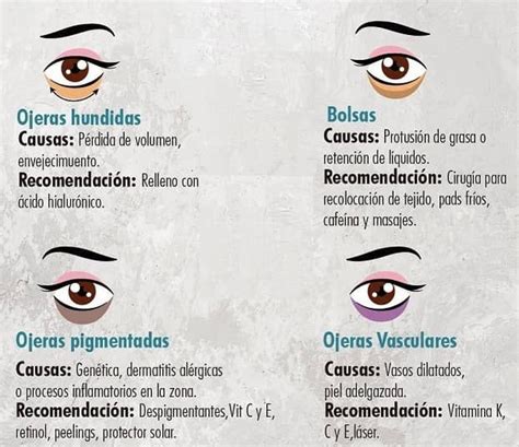Anatomía del contorno de ojos y tipos de ojeras