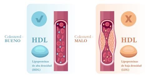 Diagrama mostrando cómo las antocianinas reducen el colesterol LDL