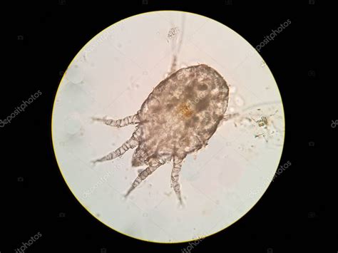 Ilustración de un ácaro del queso bajo microscopio