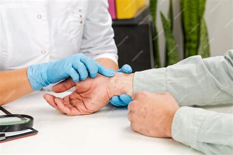 Médico examinando la piel de un paciente