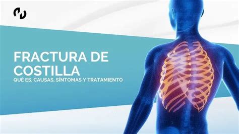 Ilustración de ejercicios prohibidos para fractura de costilla
