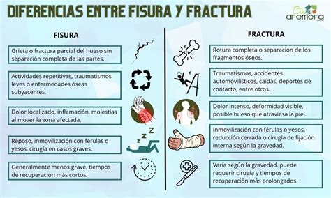 Infografía comparativa entre fractura y fisura de costilla