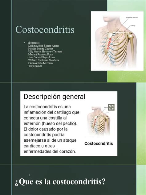 Diferencia entre agujetas y costocondritis