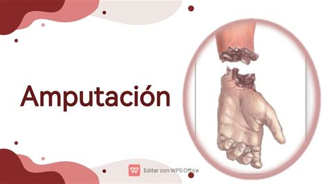 Herramientas para descorne por amputación