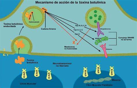 Esquema del mecanismo de acción de la toxina botulínica