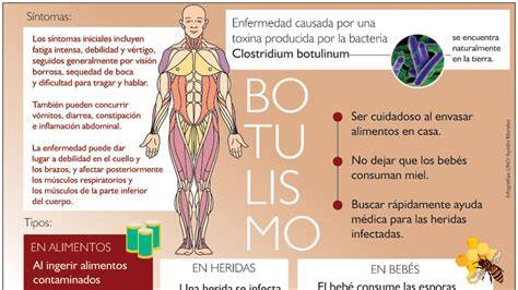 Tabla de síntomas del botulismo