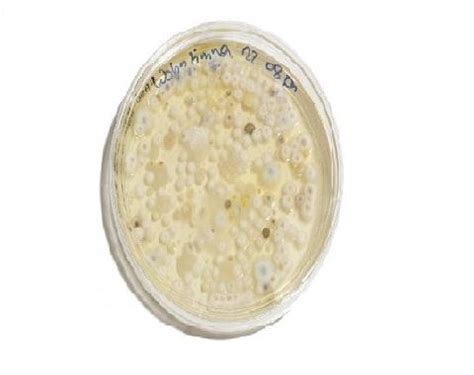 Placa de Petri con Agar Papa Dextrosa y colonias de hongos