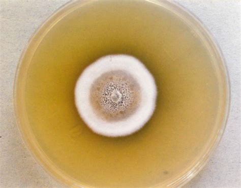 Microscopio con imagen de levaduras en Agar Papa Dextrosa