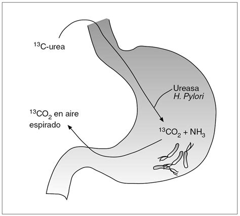 Gráfico del fundamento de la prueba de aliento con urea marcada con 13C