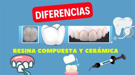 Infografía: Comparativa de propiedades entre cerámica HeraCeram y resina de alto impacto