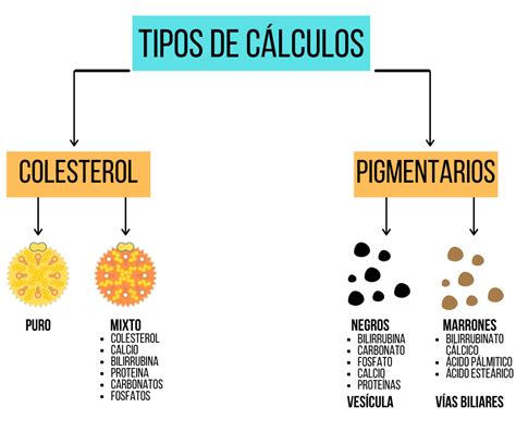 Tipos de cálculos biliares