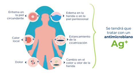 Signos de infección en una herida