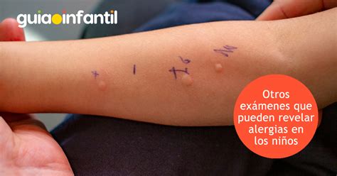 Dispositivos de identificación de alergias para niños