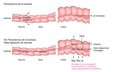 Proceso de digestión de la lactosa en personas con y sin intolerancia