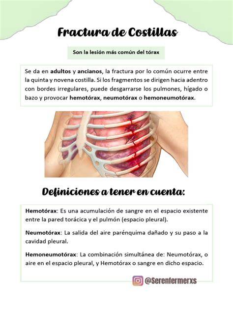 Factores de riesgo y causas de las fracturas de costilla